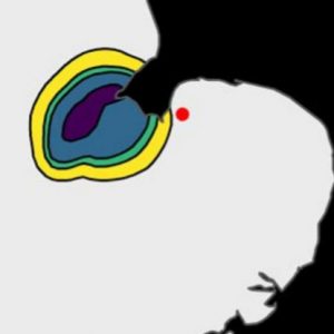 DNA-map